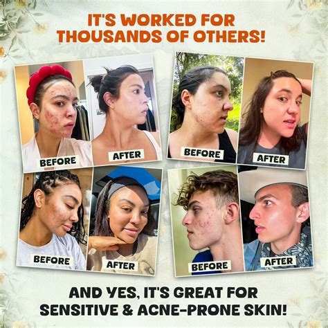 EVIL GOODS! Whipped Beef Tallow and Manuka Honey Balm, 4oz, Organic Fa – World's BEST Beef ...