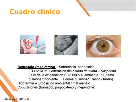 Sobredosis de opioides | PPT