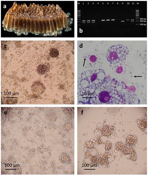 Isolation in Natural Host Cell Lines of Wolbachia Strains wPip from the ...