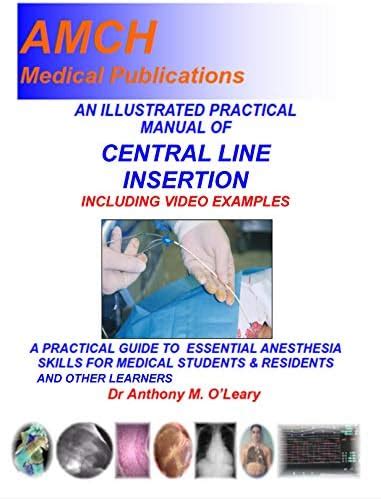 A TEXTBOOK OF CENTRAL VENOUS PRESSURE MONITORING: A practical approach ...