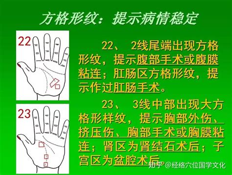 《七天学会手诊》八卦掌，疾病在手掌的对应分区 - 知乎