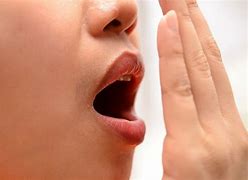 halitosis 的图像结果