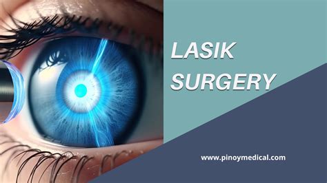 Lasik Surgery Price in the Philippines 2026 — PinoyMedical