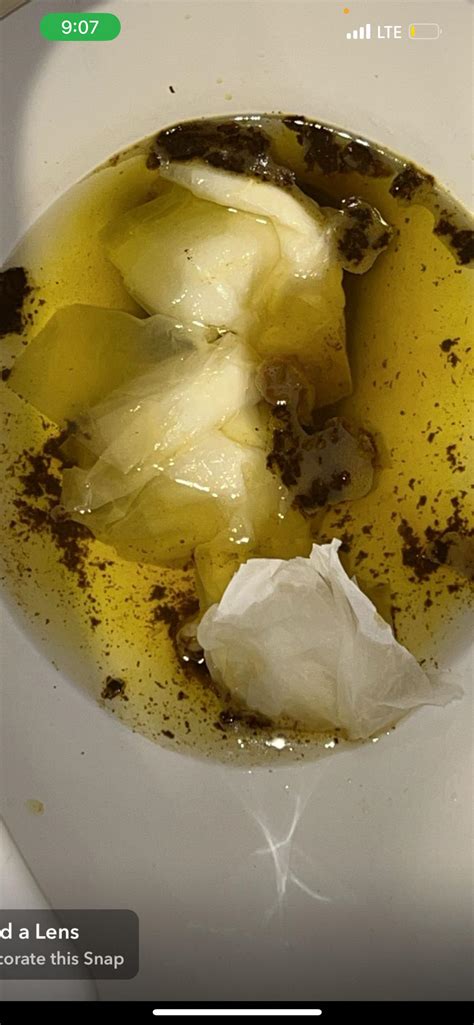 Coffee ground stool?? Concerning?? : r/medical_advice