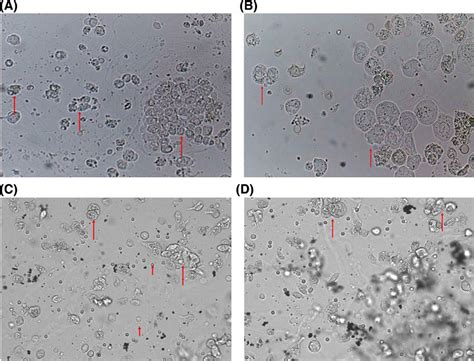 An ensemble approach of urine sediment image analysis and NMP22 test ...