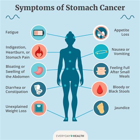Stomach Cancer: Symptoms, Causes, Diagnosis, Treatment, and Prevention