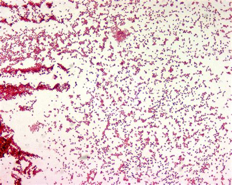 Gram Negative Coccobacilli