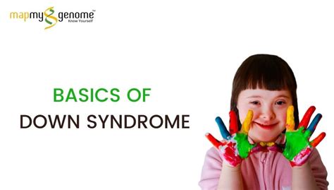Basics of Down Syndrome?