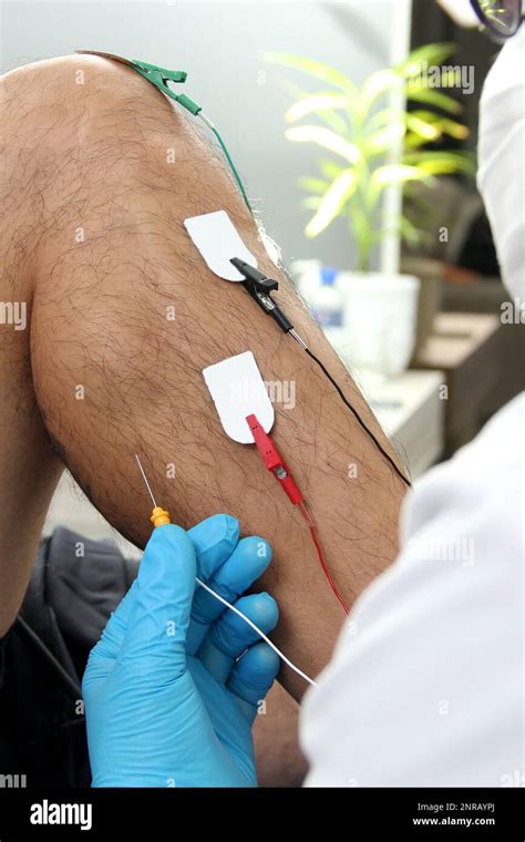 Image result for Lower Extremity EMG Testing