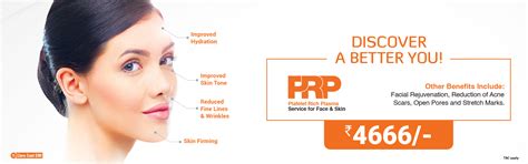 PRP Treatment