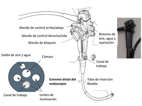 ¿Para qué sirve la endoscopia ? - Consulta de Aparato Digestivo: Médico ...