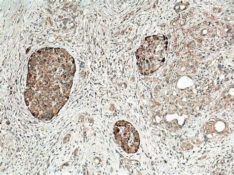 Alpha Internexin antibody (23881-1-AP) | Proteintech