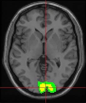 Primary Visual Cortex 的图像结果