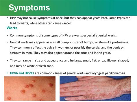 Human Papilloma Virus | PPTX