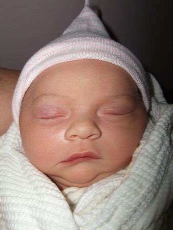 Torticollis (crooked neck) anyone (PICS ADDED)? | BabyCenter