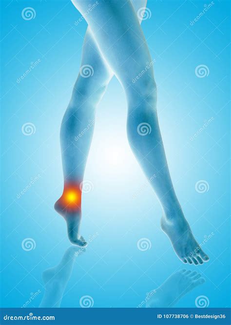 Conceptual Woman Girl Legs and Feet Hurt Ankle Pain Stock Illustration - Illustration of human ...