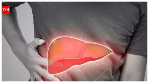 Liver Damage Symptoms: 5 (very) early signs of liver damage that can ...
