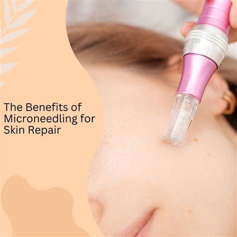 Expert Strategies for Treating Pockmarks on Your Face | Clinikally