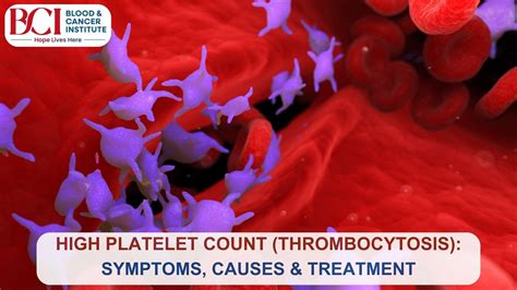 High Platelet Count (Thrombocytosis): Symptoms, Causes, and Treatment