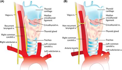 Surgical tips and techniques to avoid complications of thyroid surgery