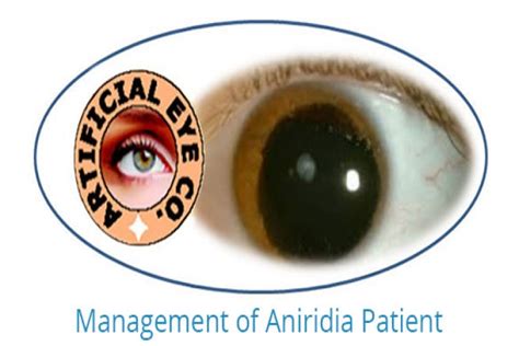 Prosthetic eye contact lenses type for light sensitivity in India