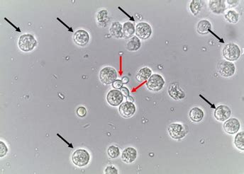 Fungal Urinary Tract Infection | Encyclopedia MDPI