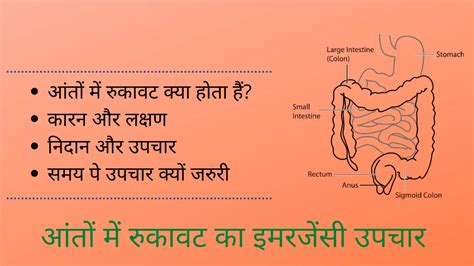 आंतों में रुकावट | Urgent Intestinal Obstruction in Hindi