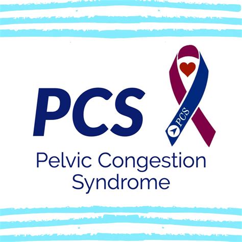 Pelvic congestion syndrome pcs – Artofit