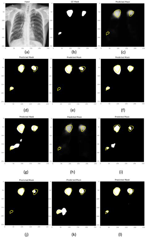 Uncertainty Quantification in Segmenting Tuberculosis-Consistent ...
