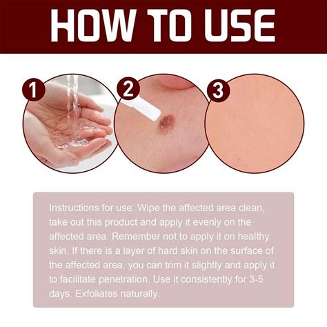 Skin Tags Moles Wart Remover Liquid Pen – Maison Luvine