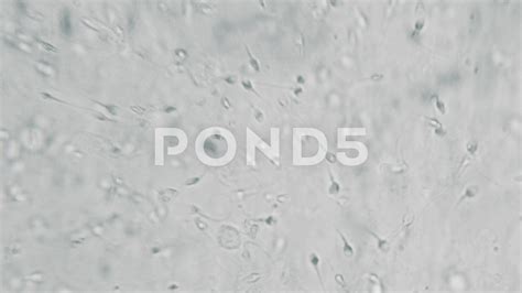 Human Sperm Under Microscope