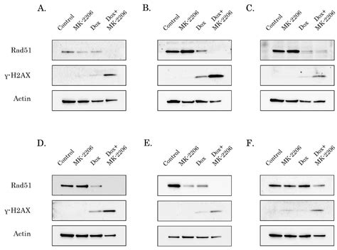 Inhibition of AKT-Signaling Sensitizes Soft Tissue Sarcomas (STS) and ...