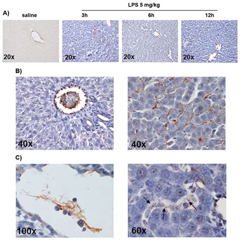 Simvastatin Prevents Liver Microthrombosis and Sepsis Induced ...