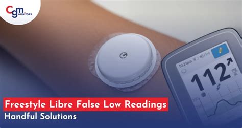 Dexcom G6 Problems 的图像结果