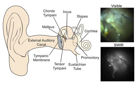 Inner Ear Infection Otoscope