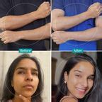 Buy 25% AHA, 2% BHA, 5% PHA Peeling Solution For Tan Removal