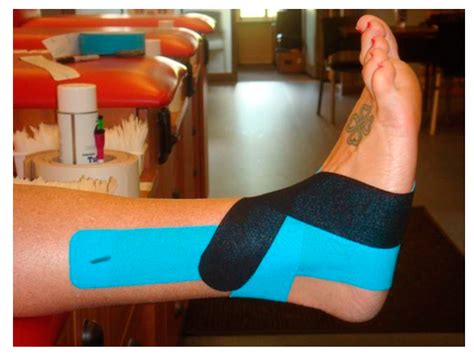 Effect of Kinesio® Taping on Ankle Complex Motion and Stiffness and ...
