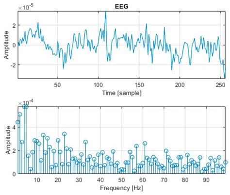 Convolutional Neural Network-Based Classification of Steady-State ...