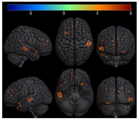 EEG and fMRI Correlates of Insight: A Pilot Study