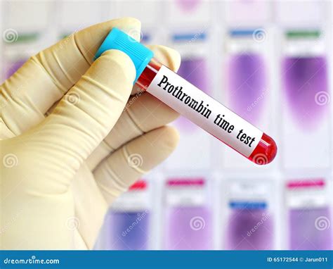 Prothrombin time test stock photo. Image of laboratory - 65172544