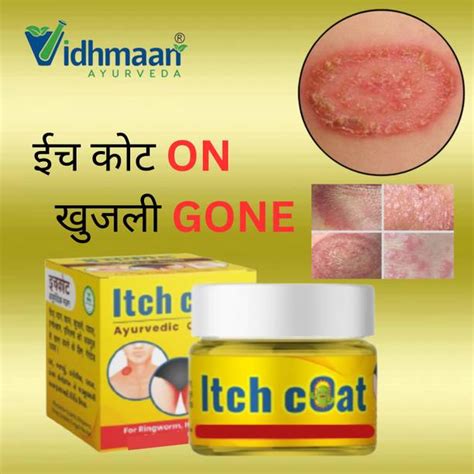 Ringworm Cream - Buy Ringworm Cream online at Best Prices in India ...