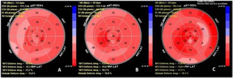 Matching Imaging and Remodulation Effects: Benefits of Cardiac ...