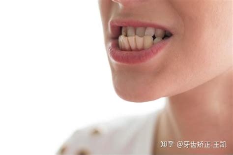 合肥美欧口腔种植牙大概多少钱?预约刘坤医生做进口种植牙价格3k+不贵 - 美佳社区