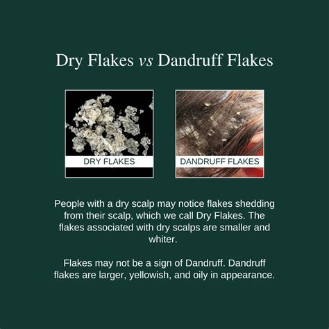 Dandruff Flakes Vs Dry Scalp Flakes Dandruff Vs. Dry Scalp: Know The