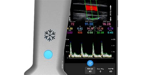 Principle of the Medical USG Transducer — Teletype