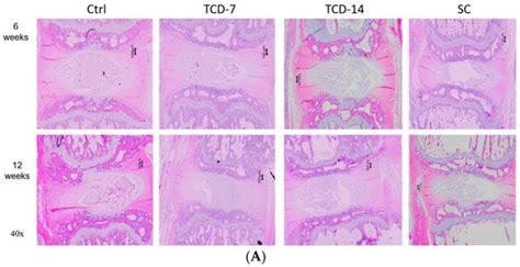 Comparative Analysis of Autophagy and Apoptosis in Disc Degeneration ...
