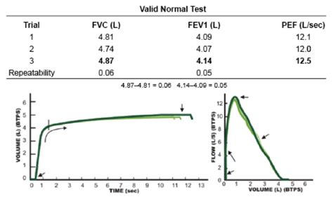 Spirometry Normal Values Chart 的图像结果