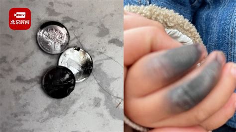 2岁幼童拿硬币塞电瓶车充电口烧黑手指 妈妈：很后怕，万幸只是伤到手_北京时间