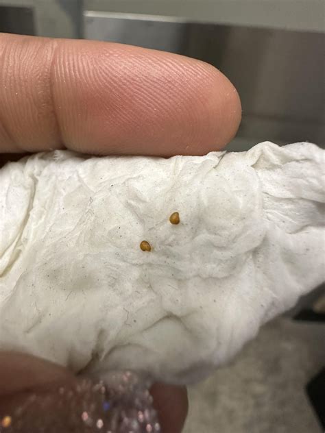 Guys I find these when I wiped after taking a poop, what is it. When I popped them, something ...