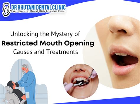 Unlocking the Mystery of Restricted Mouth Opening: Causes & Treatments